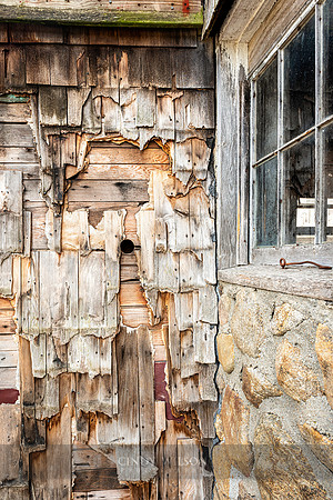 Shingles